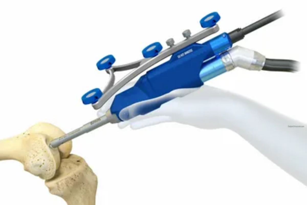 Recovery Timeline After Robotic Knee Replacement Surgery - Dr Ashish ...