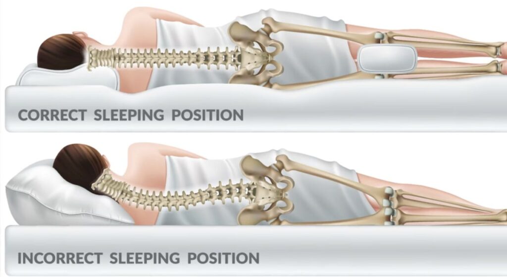Person sleeping with pillow support to reduce lower back pain